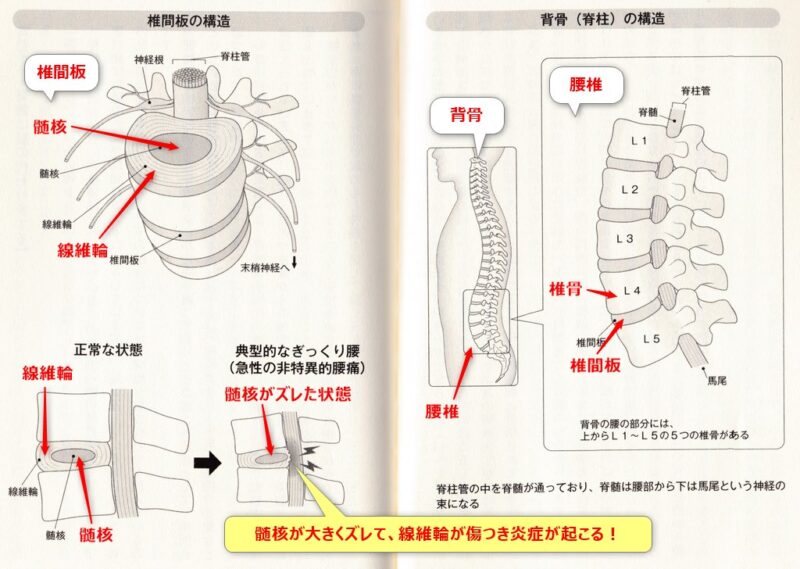 背骨と腰椎と椎間板の構造